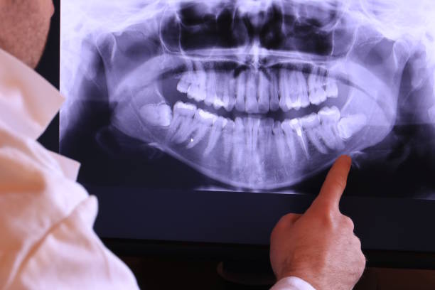 Best Pediatric Emergency Dentist in North Augusta, SC